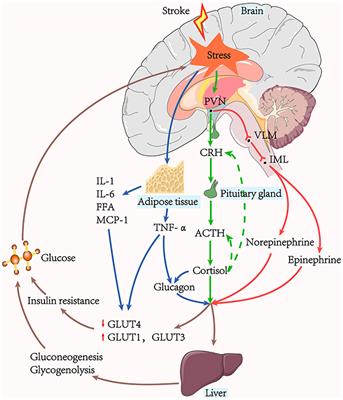 A review of stress-induced hyperglycaemia in the context of acute ischaemic stroke: Definition, underlying mechanisms, and the status of insulin therapy